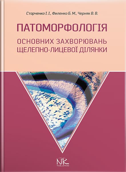 Патоморфологія основних захворювань щелепно-лицьової ділянки. // Старченко І.І., Філенко Б.М. та ін.