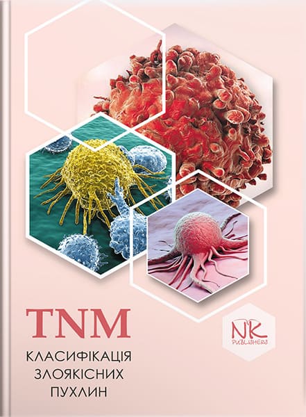 TNM класифікація злоякісних пухлин. // Шевченко А.І.(за ред.)