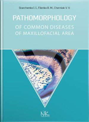 Pathomorphology of Сommon Diseases of Maxillofacial Area=Патоморфологія основних захворювань щелепно-лицевої ділянки // Старченко І.І., Филенко Б.М., Черняк В.В.