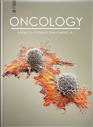 Oncology=Онкологія. Книга з електронним додатком. // Шевченко А. І., Колесник О. П., Шевченко Н. Ф. та ін.